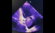 14. Echocardiography Case - What You See?