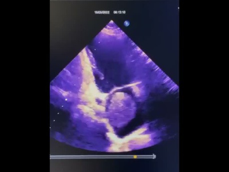 14. Echocardiography Case - What You See?