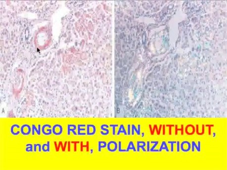 Diseases of Immunity - MSP - 6j