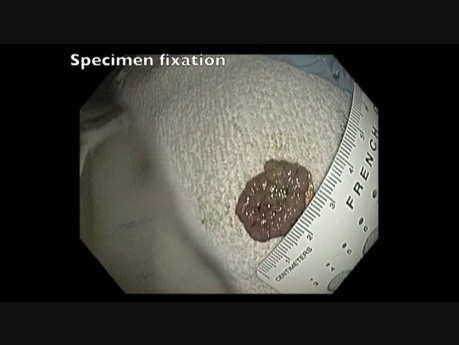 Specimen Fixation