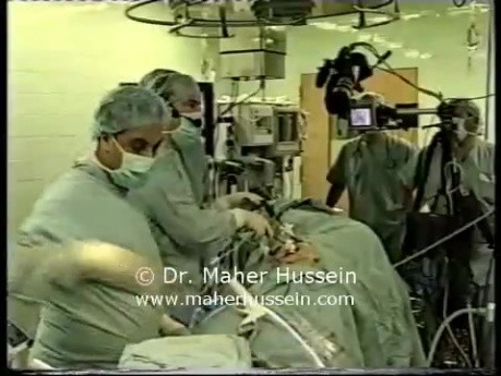Live Surgery At AUB - Part 8