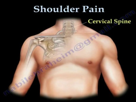 Shoulder Pain - Anatomy and Examination