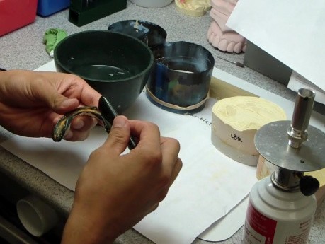 Final Denture Impression: Tips To The Reader - Impression Compound