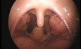 Child's Throat - 5 year old