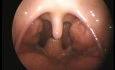 Child's Throat - 5 year old