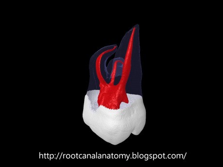 Root Canal Anatomy of Maxillary Second Molar