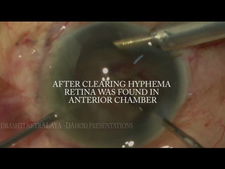 Pole To Pole Surgery