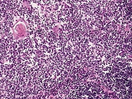 Thymus - Histology