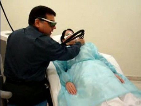 Laser hair removal
