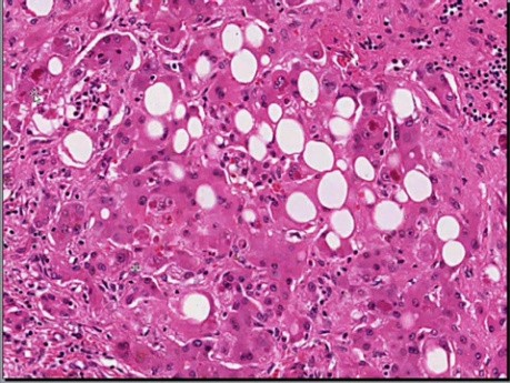 Nutritional and Environmental Diseases - MSP- 9d