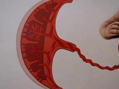 Congenital Heart Defects and Fetal CV - Lecture - 1/4