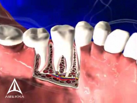 Tooth Anatomy - 3D Medical Animation 