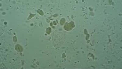 Meconium
