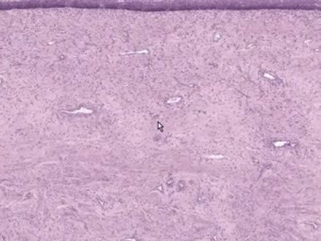 Vagina - Histology