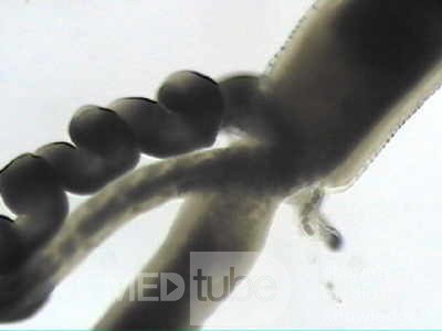 Trichuris Trichuris (whipworm) (7 of 19)