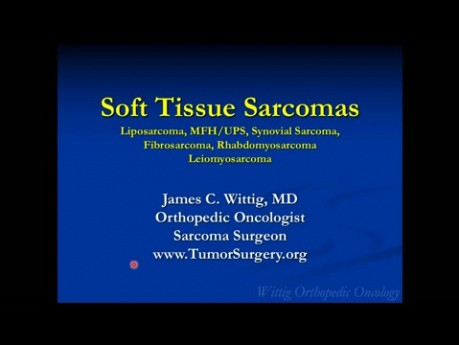 Orthopedic Oncology Course - Soft Tissue Sarcomas (Liposarcoma, MFH, etc.) - Lecture 10