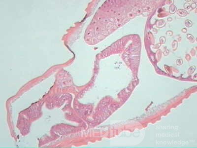Trichuris Trichuris (whipworm) (10 of 19)