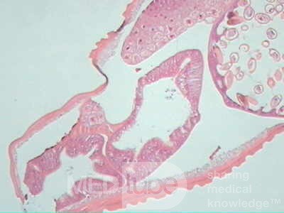 Trichuris Trichuris (whipworm) (10 of 19)
