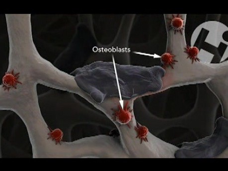 Effects of Accutane on Cancellous Bone Growth