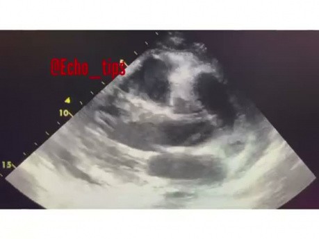 6. Echocardiography Case - What You See? 