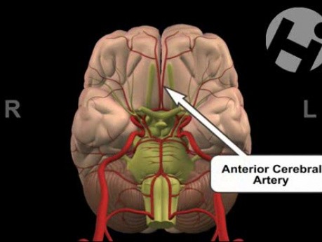 Normal Anatomy of the Brain