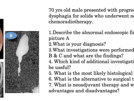 Image Based Questions - Upper GI Tract