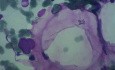 Bone Marrow - Fat cells