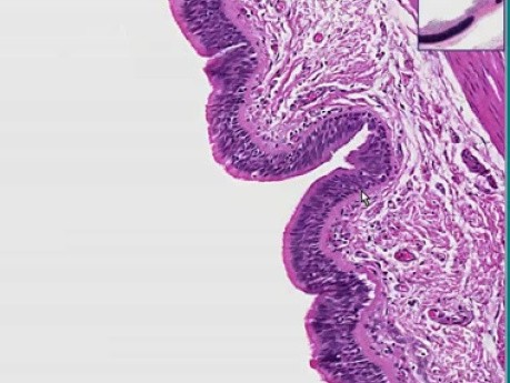 Cryptosporidium
