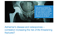 MEDtube Science 2014 - Alzheimer’s disease and osteoporosis – correlation increasing the risk of life-threatening fractures?