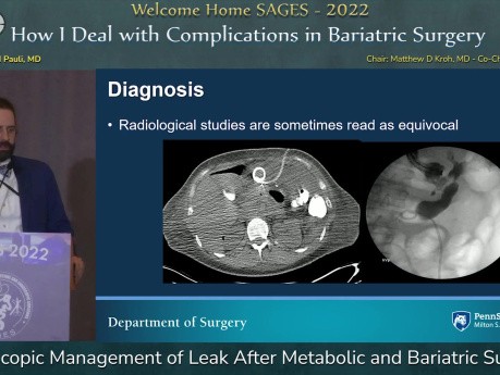 Endoscopic Management of Leak After Metabolic and Bariatric Surgery