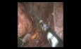 Right Adrenal Pheochromocytoma