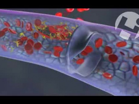 Normal Thrombus Formation