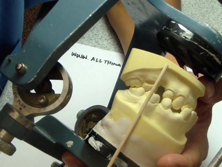 Mounting Casts What Not To Do