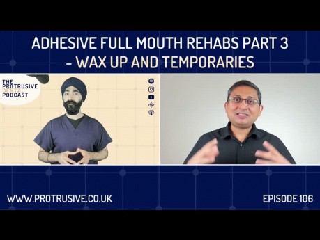 Adhesive Full Mouth Rehabs Part 2 – Wax Up and Temporaries – PDP106