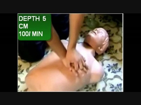 Cardiac Arrest Part 2׃ Rescuscitation - Basic Life Support (CPR)