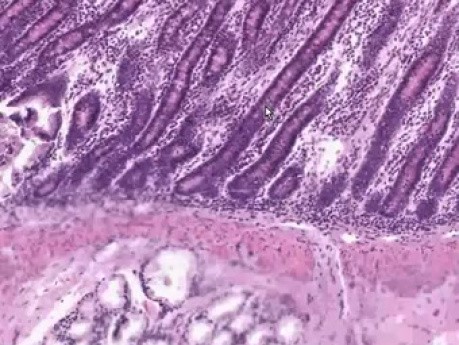 Duodenum - Histology