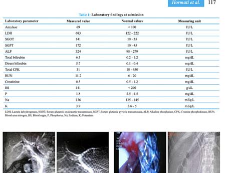 Unusual Treatment for Massive and Refractory Bleeding