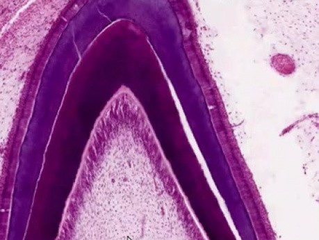 Tooth Eruption - Histology