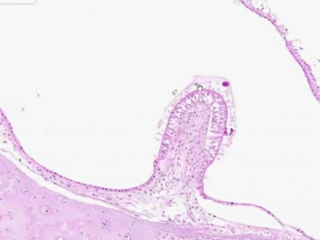Inner Ear 2 - Histology