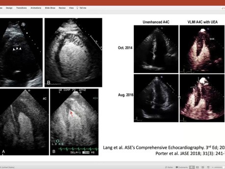 What has UEAs Got To Do with Echo Contrast