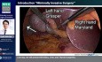 Minimally Invasive Surgery Skills