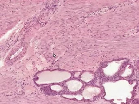 Prostate - Histology