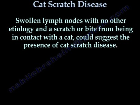 Cat Scratch Disease - Video Lecture