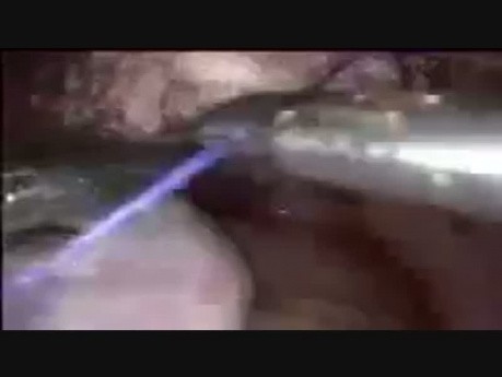 Intracorporal Suturing for Vault Closer in TLH