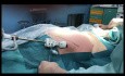 Anterior Endoscopic Component Separation