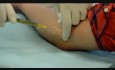 PRP (Platelet Rich Plasma) - Treatment for "Tennis Elbow" and "Golfer's Elbow"