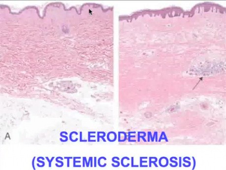Diseases of Immunity - MSP - 6g