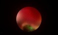 Prone PCNL Without Inserting Ureteral Catheter (View From Surgeon's Eyes)