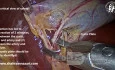 Critical View of Safety in Cholecystectomy