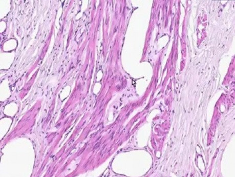 Female Urethra - Histology